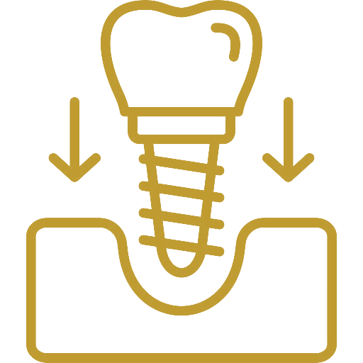 Single Implants